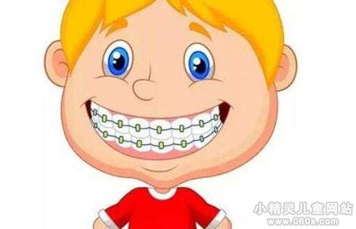 什么是儿童牙齿矫正 儿童牙齿矫正的最佳年龄